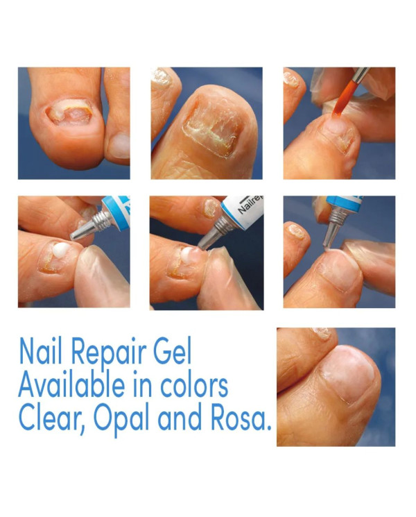 GEHWOL NAIL REPAIR GEL KLAR H 5ML