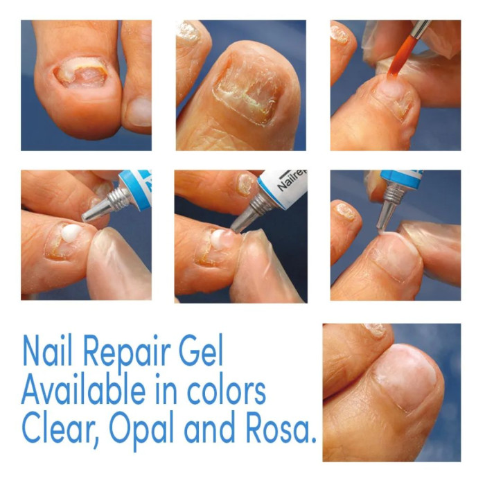 GEHWOL NAIL REPAIR GEL KLAR H 5ML